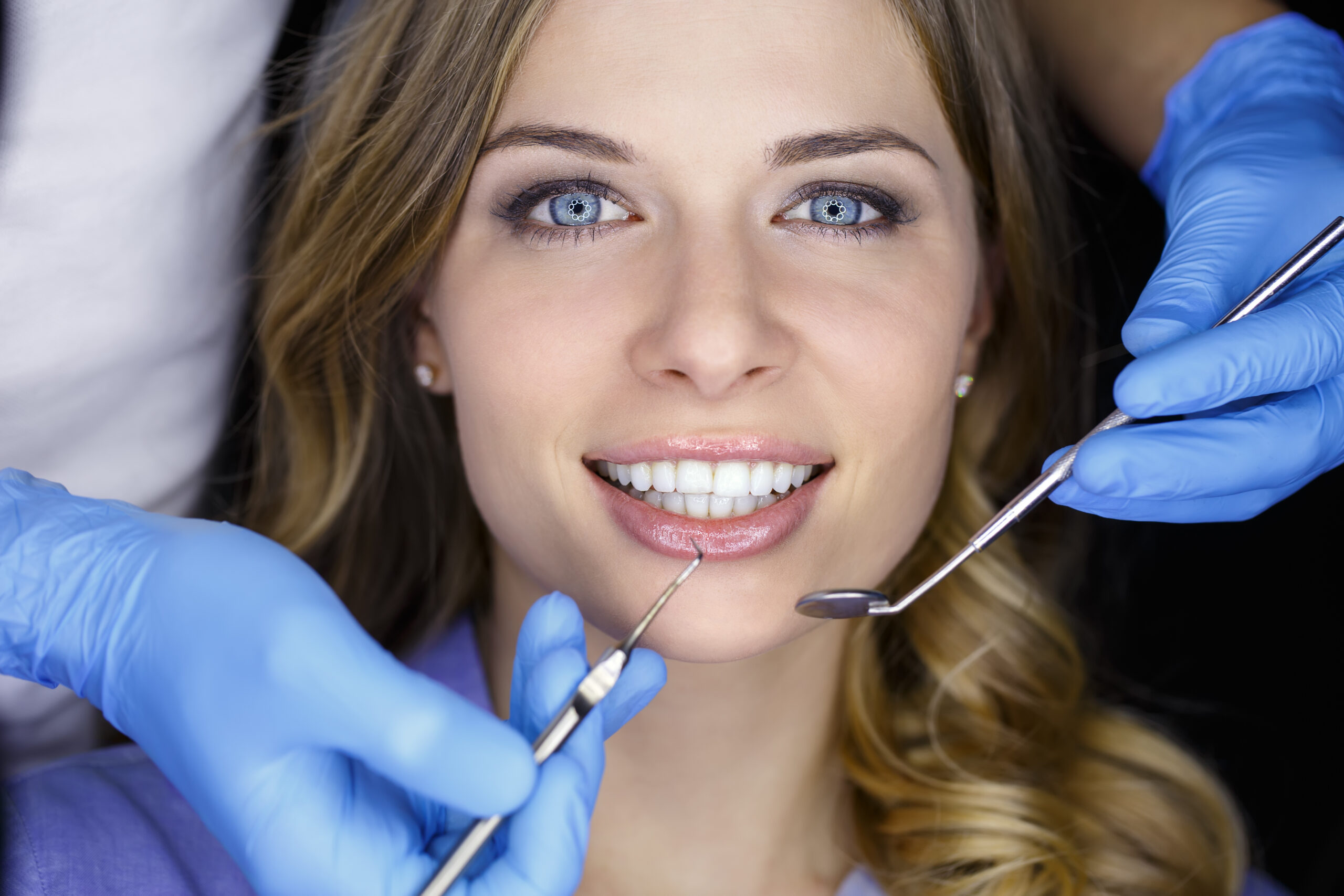 Unveiling the Radiance: Why Professional Laser Teeth Whitening Outshines Veneers